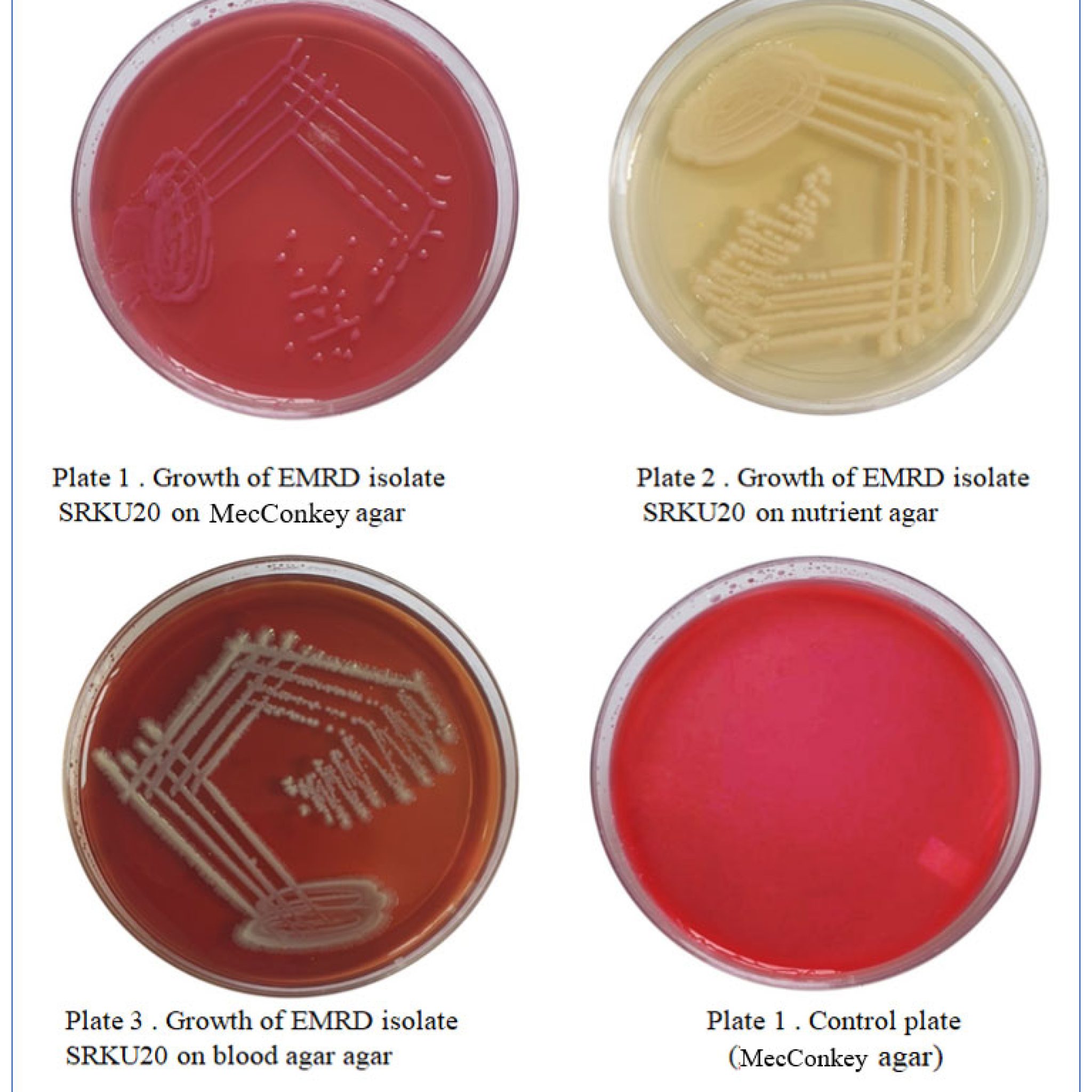 Pathophysiology Of Multidrug Resistant Klebseilla Pneumoniae Causing