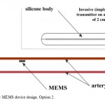Figure 2 – MEMS device design. Option 2.