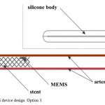 Figure 3 – MEMS device design. Option 3.