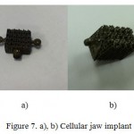Figure 7. a), b) Cellular jaw implant
