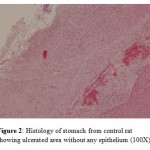 Figure 2: Histology of stomach from control rat showing ulcerated area without any epithelium (100X).