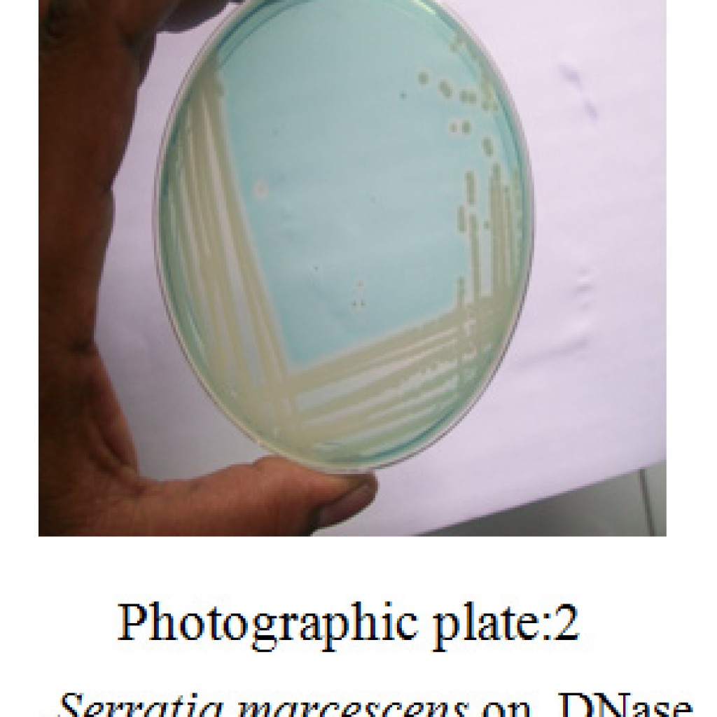 Prediction of Better Deoxyribonucleic Acid Hydrolase Producing ...