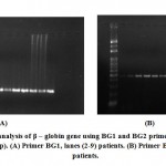 Figure 1: PCR analysis of β – globin gene using BG1 and BG2 primers. Lane (1) DNA marker (100 bp).