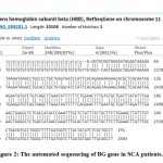 Figure 2: The automated sequencing of BG gene in SCA patients.