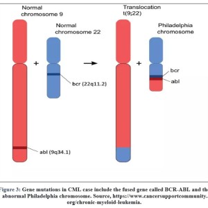 Overview of Molecular Quantification of the BCR-ABL Oncogene in CML ...